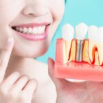 fake teeth