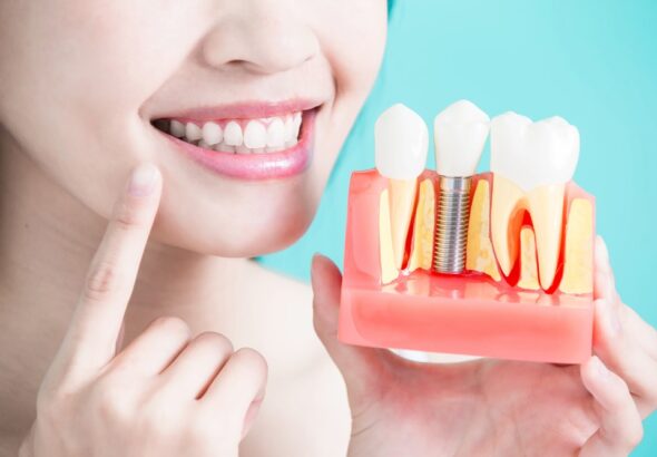 fake teeth