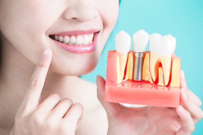fake teeth