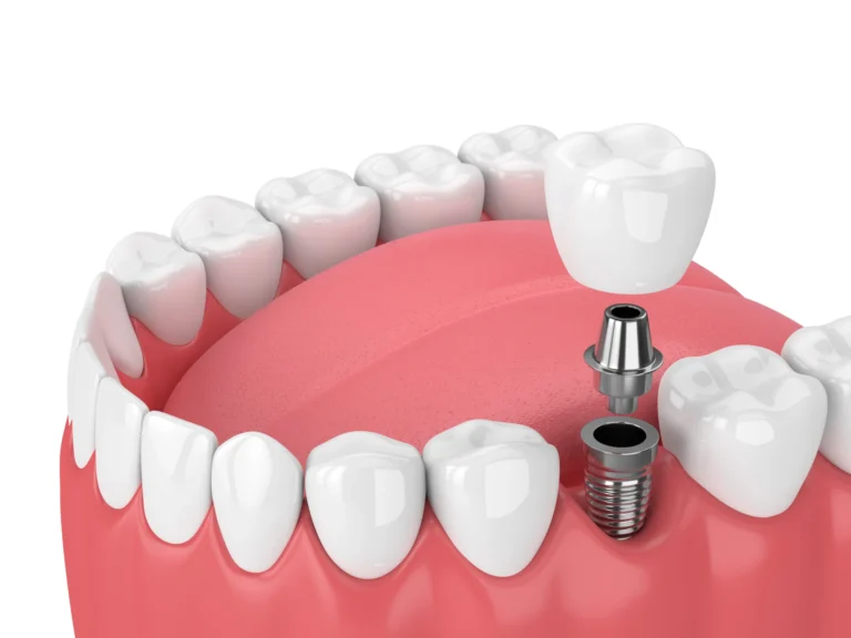 how much is a fake tooth